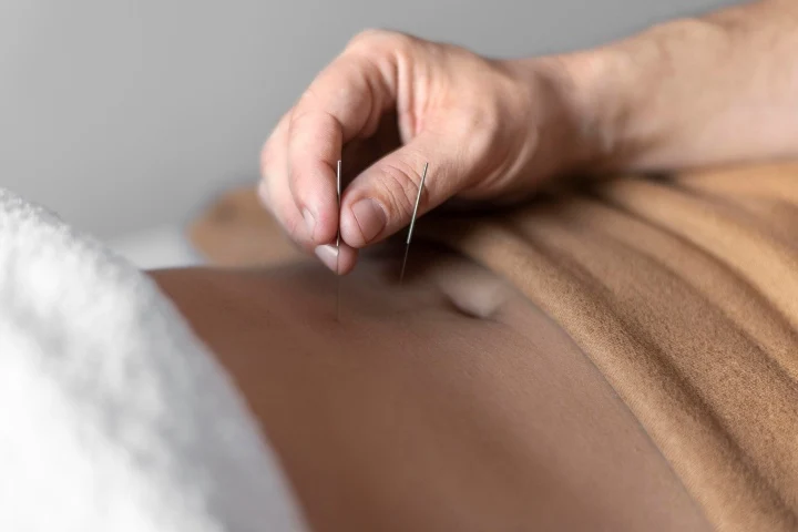 Acupuntura japonesa para la salud femenina